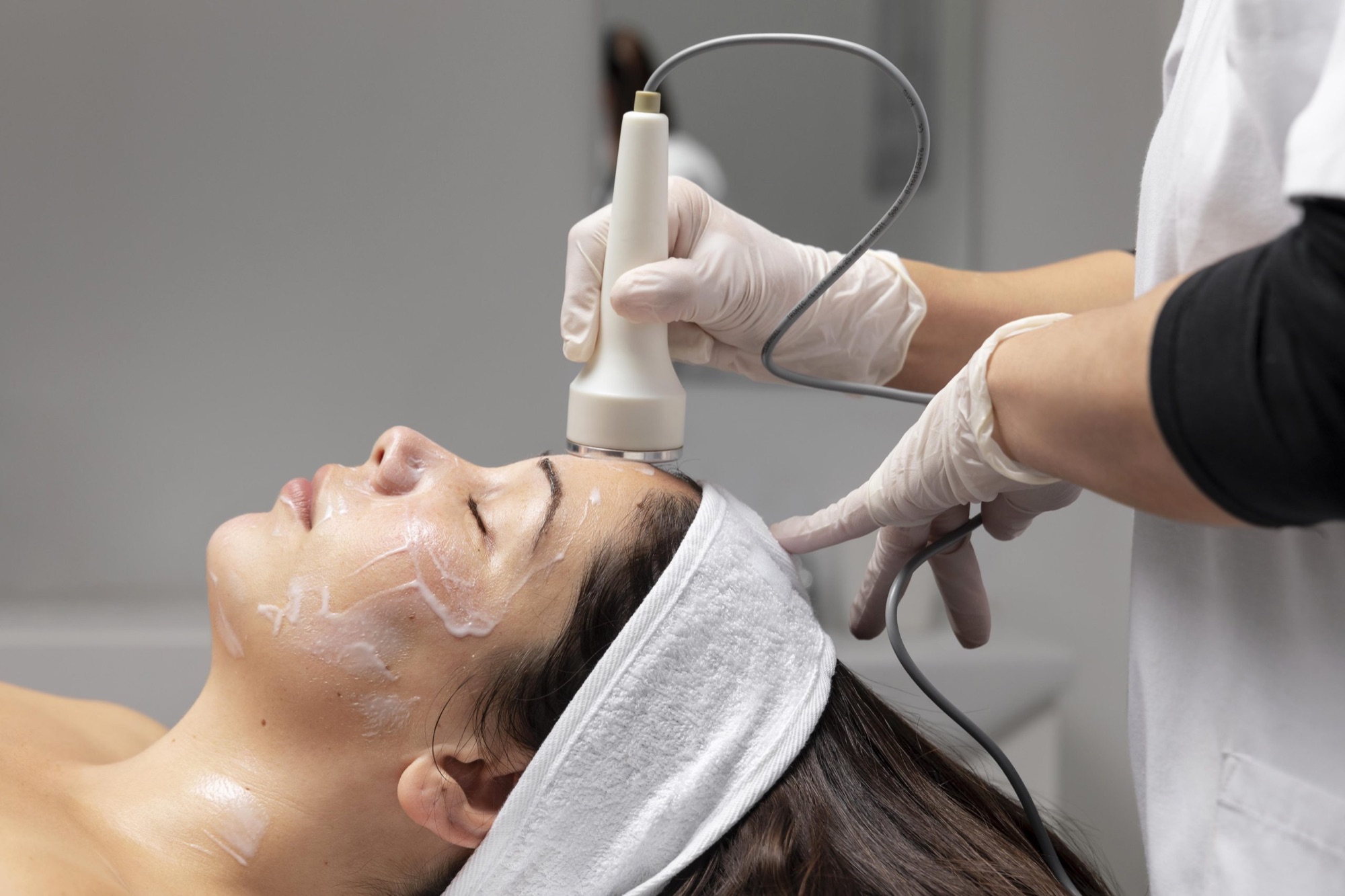 Peeling de Diamante