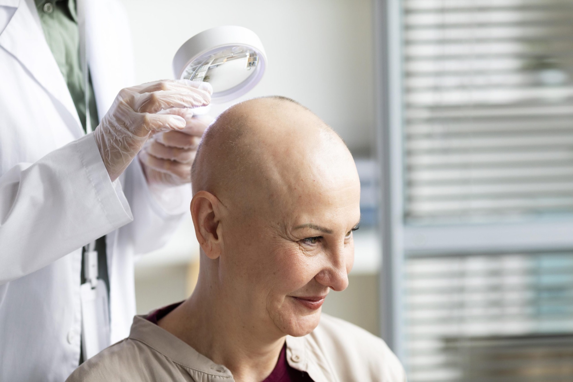 Protocolos para Alopecia