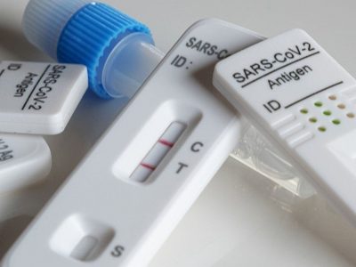 Antígenos Influenza RSV SARS-CoV-2