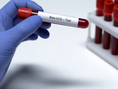 Beta hCG Gravidez