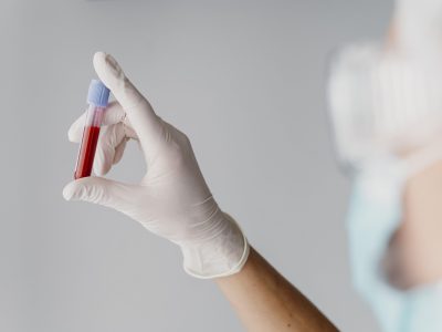 Médico segurando amostra de sangue